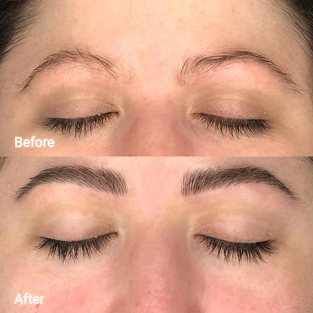 Eyebrow Growth Serum - Image 4