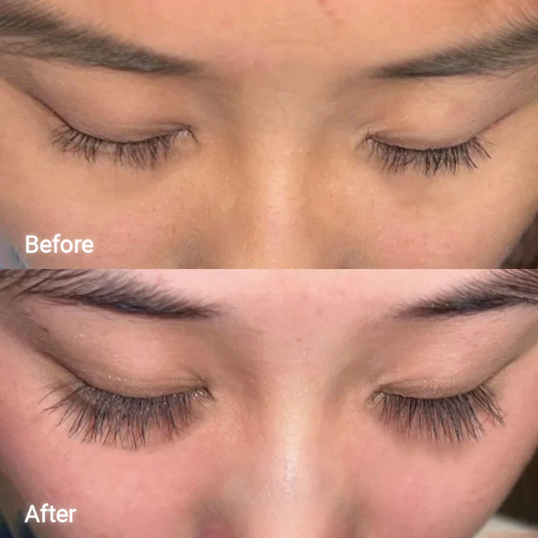 Eyelash Serum Twin Pack - Image 9