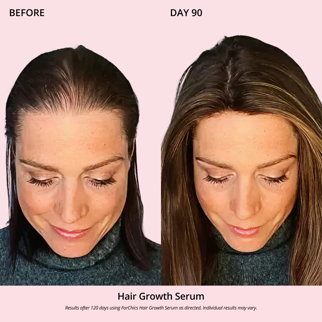 Hair Growth Oil Spray - Image 5