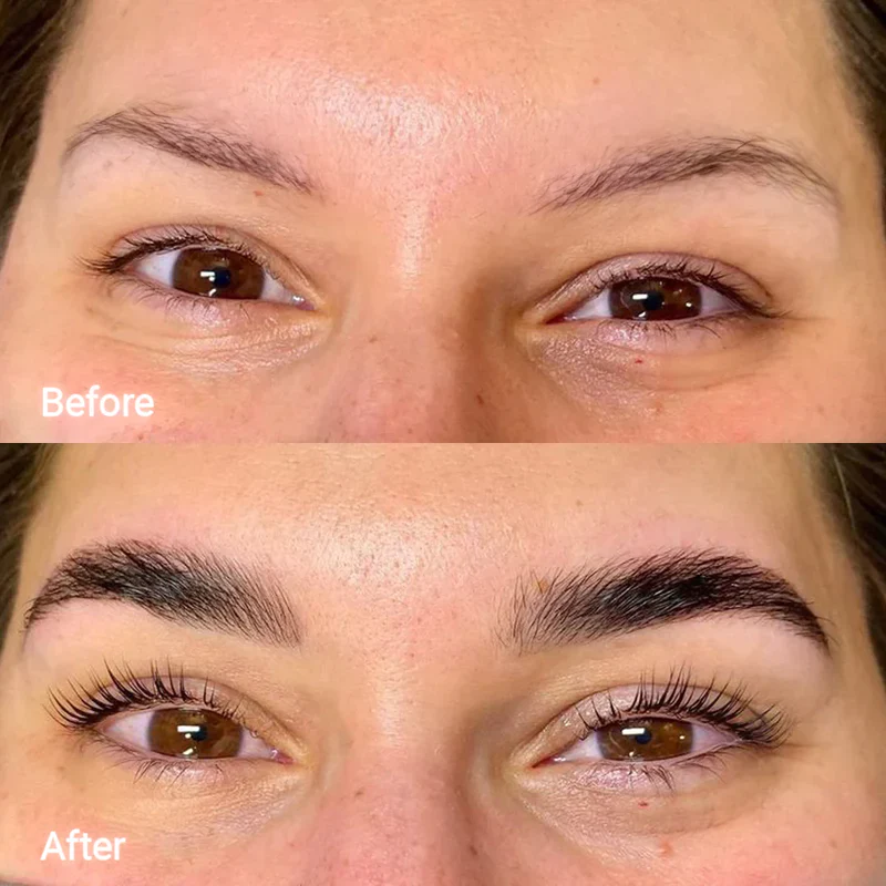 Lash and Brow Serum Set - Image 10
