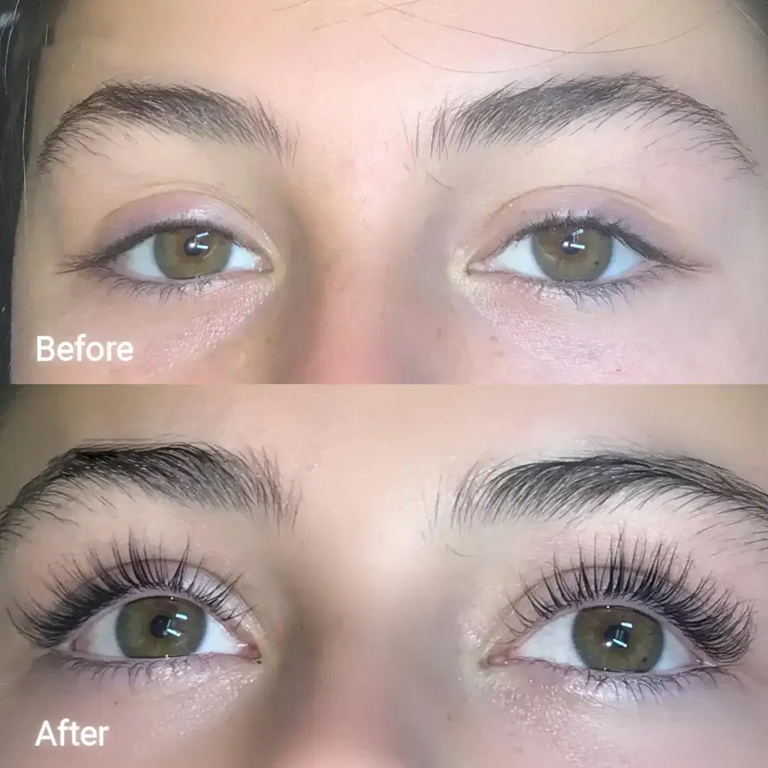 Eyelash Growth Serum - Image 4