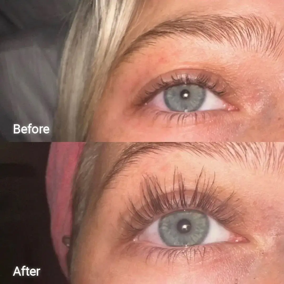 Eyelash Growth Serum - Image 7