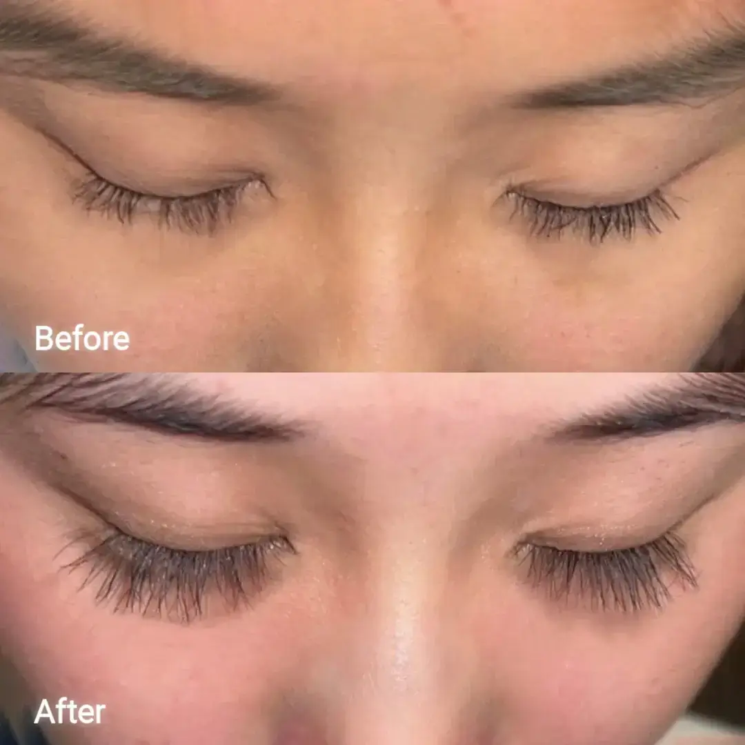Eyelash Growth Serum - Image 8